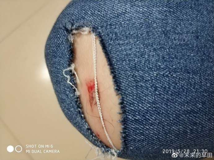 女子撕破警察裤子事件
