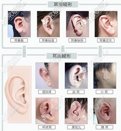 中国好耳朵中国好耳朵，文化传承与现代发展的融合-第3张图片