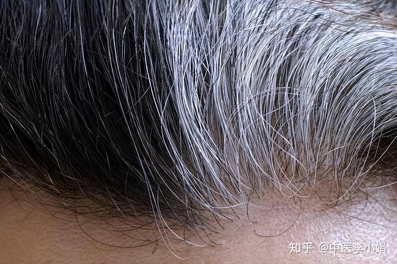 宝宝下面湿透了还嘴硬疼怎么办压在阳台玻璃上的虚荣与展示