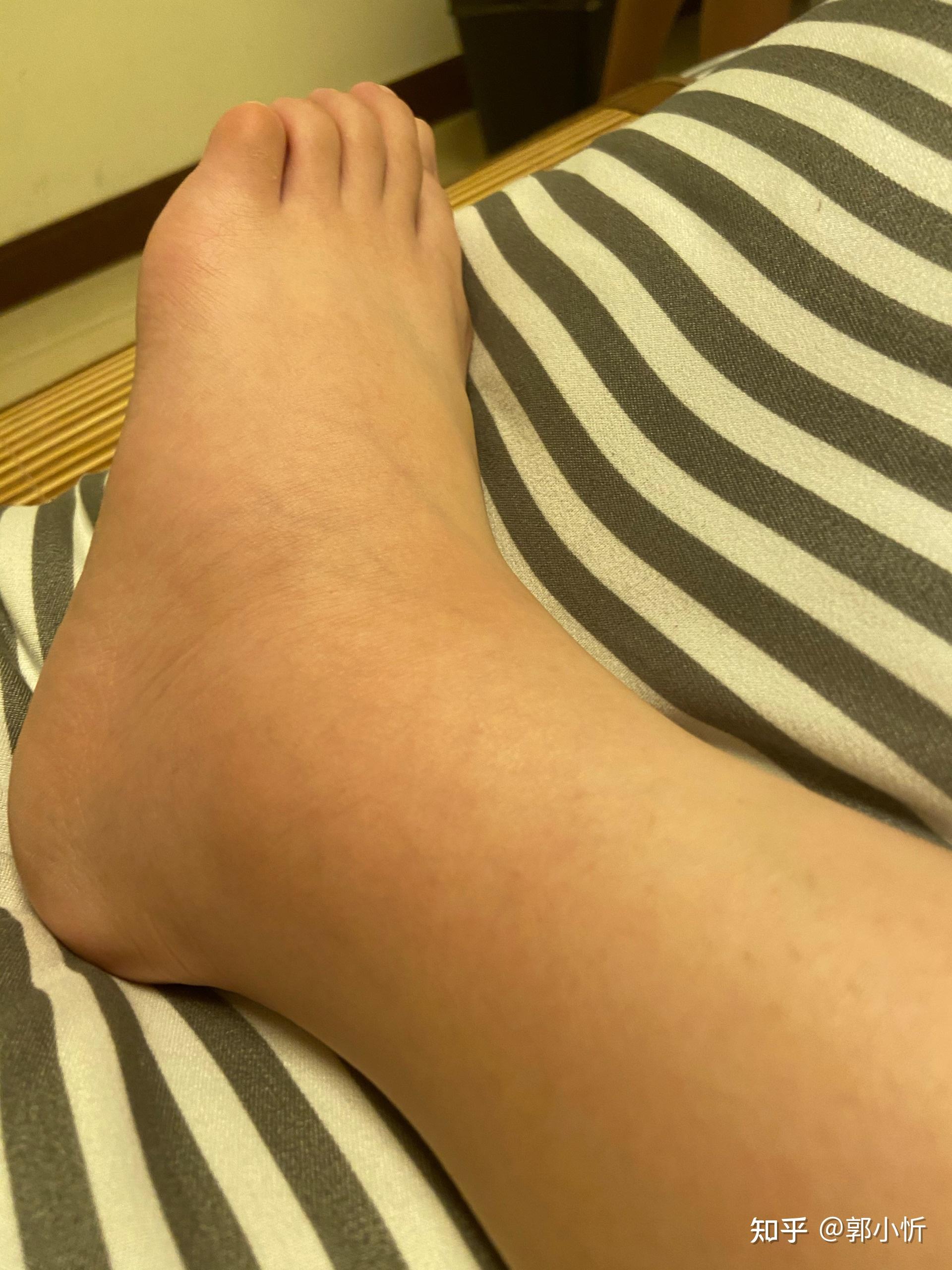 揉自己的痘痘揉到腿软的方法揉自己的痘痘揉到腿软的方法