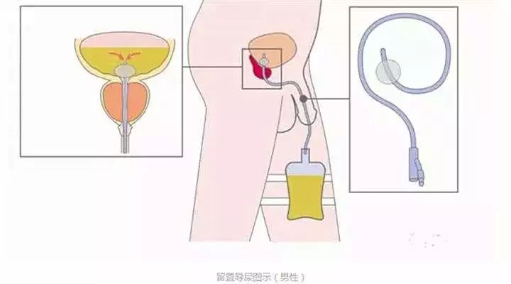 尿奴