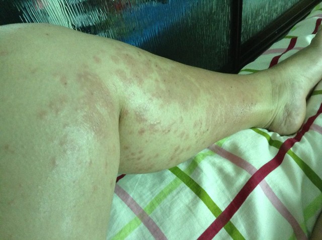 淑娟两腿间又痒了视频淑娟两腿间又痒了-第1张图片