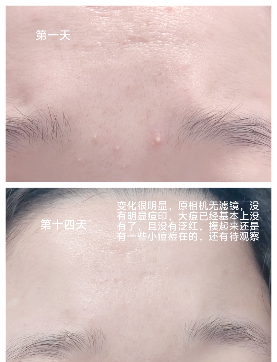女性精华液能吃吗有效果吗女性精华液能否食用-第1张图片