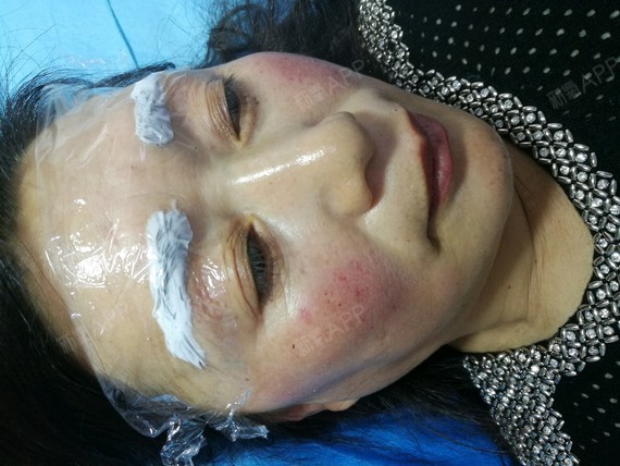 肚子里全是jy鼓起来了好难受肚子里全是jy鼓起来了好难受-第2张图片