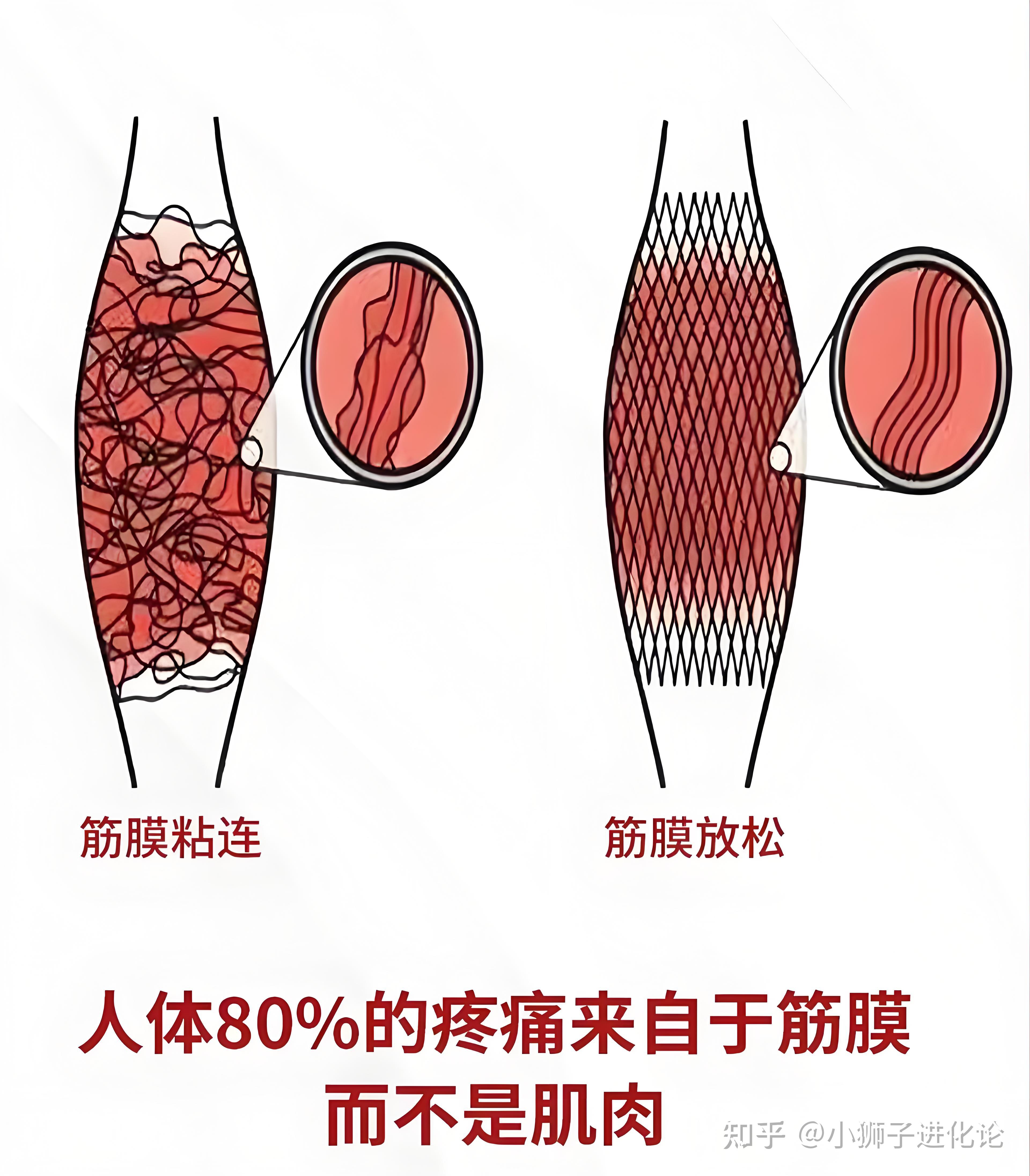 用筋膜枪打小豆豆会怎么样视频用筋膜枪打小豆豆的影响-第2张图片