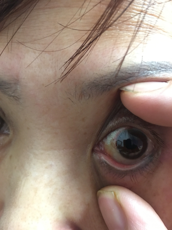 淑芳两腿间又痒了50次-第2张图片