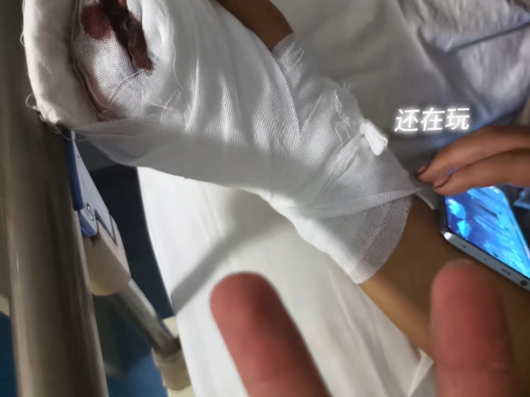 三根手指就受不了了，怎么办？-第2张图片