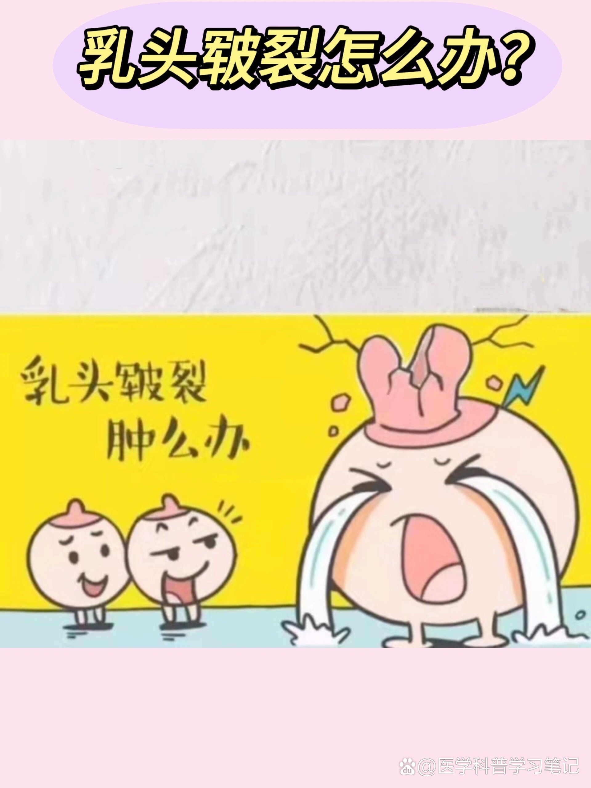 两个奶头被吃得又翘又肿的怎么办两个奶头被吃得又翘又肿-第3张图片
