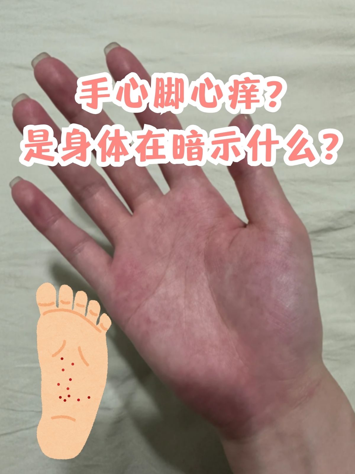 固定手脚的痒女生脚心-第3张图片