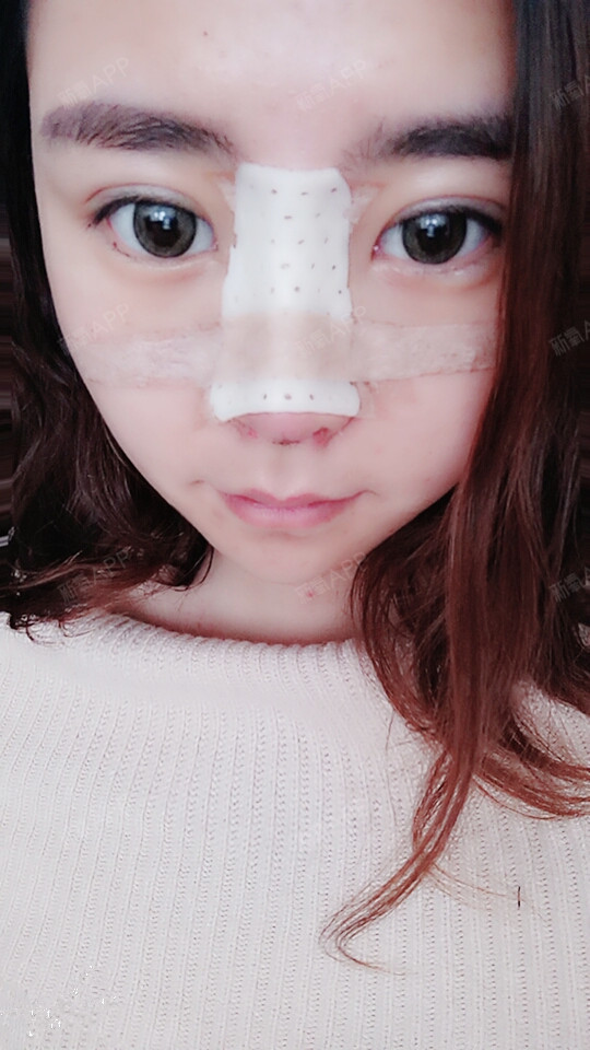 在寝室如何让室友帮助导管